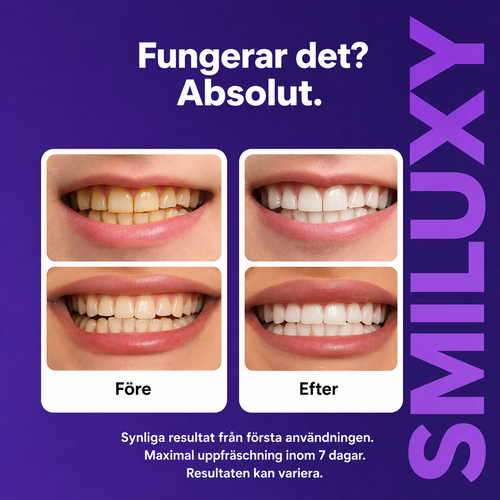 Smiluxy - Vita tänder på 30 minuter